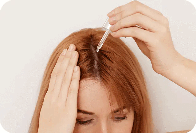 Perdita di capelli – animazione dimostrativa